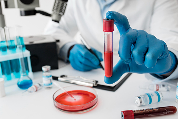 Blood Testing