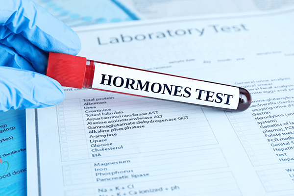 Hormone Testing
