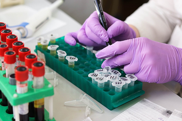 Immunology & Serology